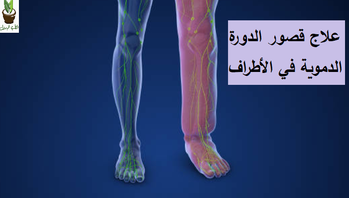 علاج ضعف الدورة الدموية في القدمين بالأعشاب: وصفات طبيعية فعالة وآمنة علاج قصور الدورة الدموية في الأطراف