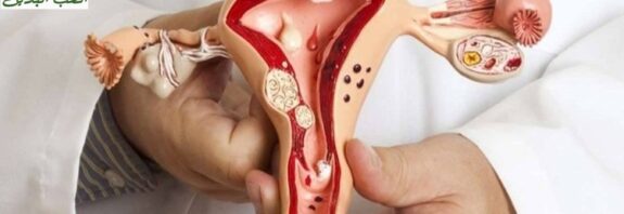 طريقة استخدام المرة لتنظيف الرحم