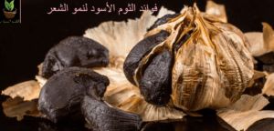 فوائد الثوم الأسود للشعر
