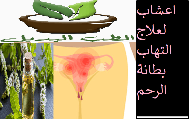 اعشاب لعلاج التهاب بطانة الرحم